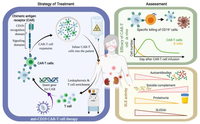 SLE患者抗CD19 CAR-T细胞治疗的工作流程