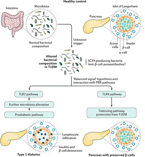 胰腺健康问题与微生物群的关系